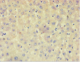 AFAP1 / AFAP Antibody - Immunohistochemistry of paraffin-embedded human liver tissue using AFAP1 Antibody at dilution of 1: 100