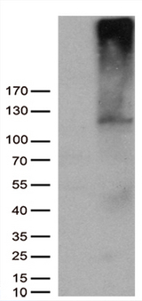 AFAP1 / AFAP Antibody - HEK293T cells were transfected with the pCMV6-ENTRY control. (Left lane) or pCMV6-ENTRY AFAP1. (Right lane) cDNA for 48 hrs and lysed. Equivalent amounts of cell lysates. (5 ug per lane) were separated by SDS-PAGE and immunoblotted with anti-AFAP1. (1:5000)