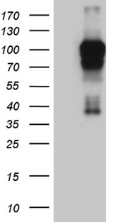 AFAP1 / AFAP Antibody - HEK293T cells were transfected with the pCMV6-ENTRY control. (Left lane) or pCMV6-ENTRY AFAP1. (Right lane) cDNA for 48 hrs and lysed. Equivalent amounts of cell lysates. (5 ug per lane) were separated by SDS-PAGE and immunoblotted with anti-AFAP1. (1:2000)