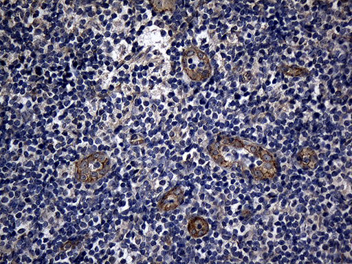 AFAP1 / AFAP Antibody - Immunohistochemical staining of paraffin-embedded Human tonsil within the normal limits using anti-AFAP1 mouse monoclonal antibody. (Heat-induced epitope retrieval by 1mM EDTA in 10mM Tris buffer. (pH8.5) at 120°C for 3 min. (1:2000)