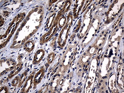 AFAP1 / AFAP Antibody - Immunohistochemical staining of paraffin-embedded Human Kidney tissue within the normal limits using anti-AFAP1 mouse monoclonal antibody. (Heat-induced epitope retrieval by 1mM EDTA in 10mM Tris buffer. (pH8.5) at 120°C for 3 min. (1:2000)
