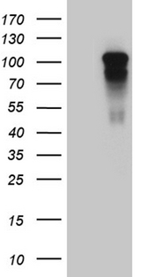 AFAP1 / AFAP Antibody - HEK293T cells were transfected with the pCMV6-ENTRY control. (Left lane) or pCMV6-ENTRY AFAP1. (Right lane) cDNA for 48 hrs and lysed