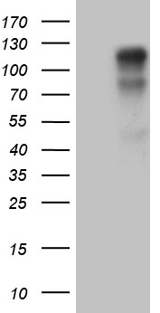 AFAP1 / AFAP Antibody - HEK293T cells were transfected with the pCMV6-ENTRY control. (Left lane) or pCMV6-ENTRY AFAP1. (Right lane) cDNA for 48 hrs and lysed. Equivalent amounts of cell lysates. (5 ug per lane) were separated by SDS-PAGE and immunoblotted with anti-AFAP1. (1:2000)