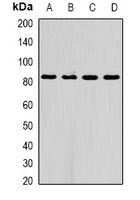 AFAP1 / AFAP Antibody - Western blot analysis of AFAP1 expression in A549 (A); HepG2 (B); mouse liver (C); rat liver (D) whole cell lysates.