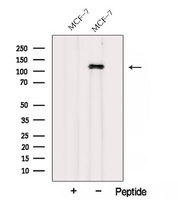 AFAP1 / AFAP Antibody - Western blot analysis of extracts of HepG2 cells using AFAP1 antibody. The lane on the left was treated with blocking peptide.