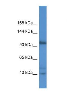 AFAP1L2 / XB130 Antibody - AFAP1L2 / KIAA1914 antibody Western blot of ACHN Cell lysate. Antibody concentration 1 ug/ml.  This image was taken for the unconjugated form of this product. Other forms have not been tested.