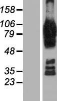 AFAP1L2 / XB130 Protein - Western validation with an anti-DDK antibody * L: Control HEK293 lysate R: Over-expression lysate