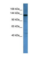 AFF1 / AF4 Antibody - AFF1 antibody Western blot of Mouse Kidney lysate. This image was taken for the unconjugated form of this product. Other forms have not been tested.
