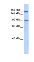 AFF2 / OX19 Antibody - AFF2 antibody Western blot of Fetal Lung lysate. This image was taken for the unconjugated form of this product. Other forms have not been tested.
