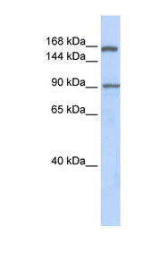 AFF2 / OX19 Antibody - AFF2 antibody Western blot of Fetal Lung lysate. This image was taken for the unconjugated form of this product. Other forms have not been tested.