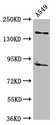 AFF2 / OX19 Antibody - Positive Western Blot detected in A549 whole cell lysate. All lanes: AFF2 antibody at 5 µg/ml Secondary Goat polyclonal to rabbit IgG at 1/50000 dilution. Predicted band size: 145, 141, 48, 144, 106 KDa. Observed band size: 145 KDa