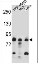 AFG3L2 Antibody - AFG3L2 Antibody western blot of MDA-MB453,MCF-7,Jurkat cell line lysates (35 ug/lane). The AFG3L2 antibody detected the AFG3L2 protein (arrow).
