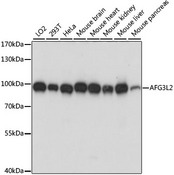 AFG3L2 Antibody - Western blot analysis of extracts of various cell lines, using AFG3L2 antibody at 1:1000 dilution. The secondary antibody used was an HRP Goat Anti-Rabbit IgG (H+L) at 1:10000 dilution. Lysates were loaded 25ug per lane and 3% nonfat dry milk in TBST was used for blocking. An ECL Kit was used for detection and the exposure time was 5s.