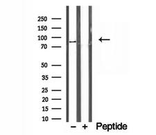AFG3L2 Antibody - Western blot analysis of extracts of HeLa cells using AFG3L2 antibody.
