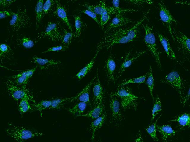 AFG3L2 Antibody - Immunofluorescence staining of AFG3L2 in U251MG cells. Cells were fixed with 4% PFA, permeabilzed with 0.1% Triton X-100 in PBS, blocked with 10% serum, and incubated with rabbit anti-Human AFG3L2 polyclonal antibody (dilution ratio 1:200) at 4°C overnight. Then cells were stained with the Alexa Fluor 488-conjugated Goat Anti-rabbit IgG secondary antibody (green) and counterstained with DAPI (blue). Positive staining was localized to Cytoplasm.
