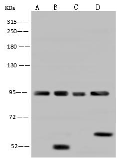 AFG3L2 Antibody - Anti-AFG3L2 rabbit polyclonal antibody at 1:500 dilution. Lane A: Hela Whole Cell Lysate. Lane B: MDA-MB453 Whole Cell Lysate. Lane C: MCF-7 Whole Cell Lysate. Lane D: Jurkat Whole Cell Lysate. Lysates/proteins at 30 ug per lane. Secondary: Goat Anti-Rabbit IgG (H+L)/HRP at 1/10000 dilution. Developed using the ECL technique. Performed under reducing conditions. Predicted band size: 89 kDa. Observed band size: 95 kDa. (We are unsure as to the identity of these extra bands.)
