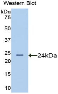 AFM / Afamin Antibody - Western blot of recombinant AFM / Afamin.  This image was taken for the unconjugated form of this product. Other forms have not been tested.