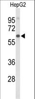 AFM / Afamin Antibody - Western blot of AFM Antibody in HepG2 cell line lysates (35 ug/lane). AFM (arrow) was detected using the purified antibody.