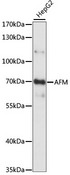 AFM / Afamin Antibody - Western blot analysis of extracts of HepG2 cells, using AFM antibody at 1:1000 dilution. The secondary antibody used was an HRP Goat Anti-Rabbit IgG (H+L) at 1:10000 dilution. Lysates were loaded 25ug per lane and 3% nonfat dry milk in TBST was used for blocking. An ECL Kit was used for detection and the exposure time was 1S.