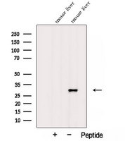 AFMID Antibody - Western blot analysis of extracts of mouse liver tissue using AFMID antibody. The lane on the left was treated with blocking peptide.