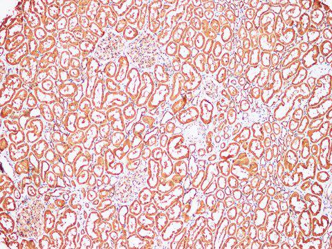 AFP Antibody - Immunohistochemistry of paraffin-embedded Human kidney using AFP Polyclonl Antibody at dilution of 1:200(100×).