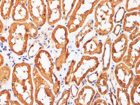 AFP Antibody - Immunohistochemistry of paraffin-embedded Human kidney using AFP Polyclonl Antibody at dilution of 1:200(400×).
