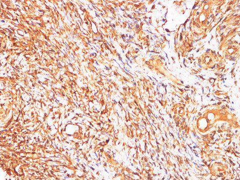 AFP Antibody - Immunohistochemistry of paraffin-embedded Human ovary using AFP Polyclonl Antibody at dilution of 1:200.