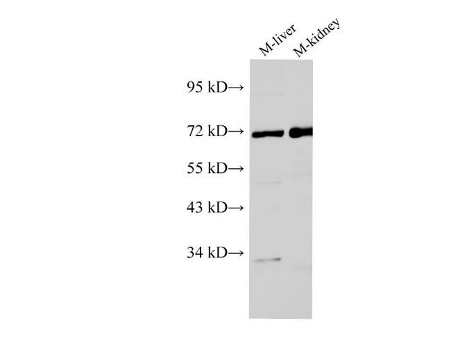 AFP Antibody - Western Blot analysis of Mouse liver and Mouse kidney using AFP Polyclonal Antibody at dilution of 1:1000.