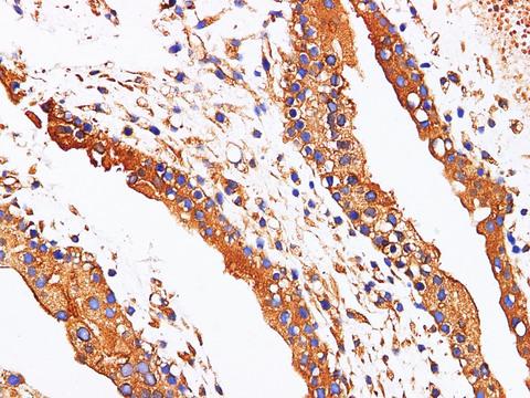 AFP Antibody - Immunohistochemistry of paraffin-embedded Human placenta using AFP Polyclonl Antibody at dilution of 1:200.