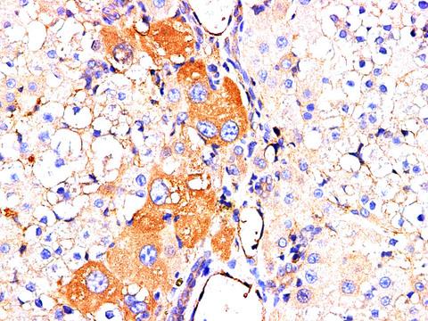 AFP Antibody - Immunohistochemistry of paraffin-embedded Rat liver using AFP Polyclonl Antibody at dilution of 1:200.