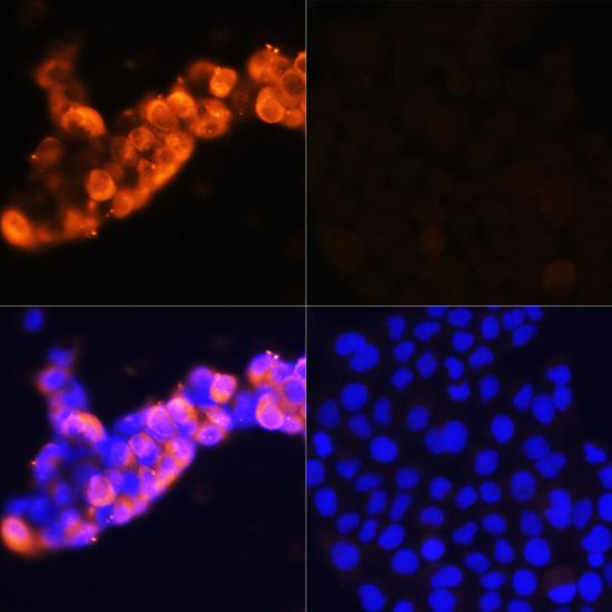 AFP Antibody - Immunofluorescence analysis of HepG2 cells (upper left) and LO2 cells (negative sample control) (upper right) using AFP Polyclonal Antibody at dilution of 1:100.Blue: DAPI for nuclear staining.