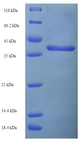 CTSL / Cathepsin L Protein