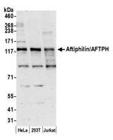 AFTPH Antibody - Detection of human Aftiphilin/AFTPH by western blot. Samples: Whole cell lysate (50 µg) from HeLa, HEK293T, and Jurkat cells prepared using NETN lysis buffer. Antibody: Affinity purified rabbit anti-Aftiphilin/AFTPH antibody used for WB at 0.1 µg/ml. Detection: Chemiluminescence with an exposure time of 3 minutes.