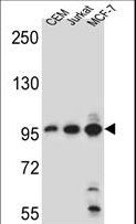 AFTPH Antibody - AFTPH Antibody western blot of CEM,Jurkat,MCF-7 cell line lysates (35 ug/lane). The AFTPH antibody detected the AFTPH protein (arrow).