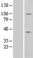 AFTPH Protein - Western validation with an anti-DDK antibody * L: Control HEK293 lysate R: Over-expression lysate