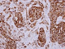 AG3 / AGR3 Antibody - IHC of paraffin-embedded A549 xenograft using AGR3 antibody at 1:500 dilution.