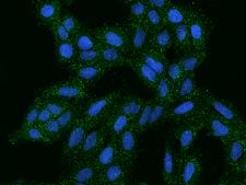 AG3 / AGR3 Antibody - Immunofluorescence staining of AGR3 in U2OS cells. Cells were fixed with 4% PFA, permeabilzed with 0.1% Triton X-100 in PBS, blocked with 10% serum, and incubated with rabbit anti-Human AGR3 polyclonal antibody (dilution ratio 1:100) at 4°C overnight. Then cells were stained with the Alexa Fluor 488-conjugated Goat Anti-rabbit IgG secondary antibody (green) and counterstained with DAPI (blue). Positive staining was localized to Cytoplasm.