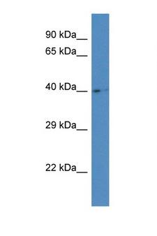 AGA / Aspartylglucosaminidase Antibody - AGA antibody Western blot of Placenta lysate. Antibody concentration 1 ug/ml.  This image was taken for the unconjugated form of this product. Other forms have not been tested.