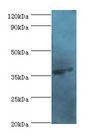 AGA / Aspartylglucosaminidase Antibody - Western blot. All lanes: N(4)-(beta-N-acetylglucosaminyl)-L-asparaginase antibody at 2 ug/ml+mouse muscle tissue. Secondary antibody: goat polyclonal to rabbit at 1:10000 dilution. Predicted band size: 37 kDa. Observed band size: 37 kDa.  This image was taken for the unconjugated form of this product. Other forms have not been tested.