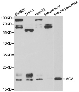 AGA / Aspartylglucosaminidase Antibody - Western blot analysis of extracts of various cell lines.
