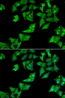 AGA / Aspartylglucosaminidase Antibody - Immunofluorescence analysis of HeLa cells.