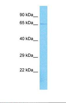 AGAP11 Antibody - Western blot of Human 293T. AGAP11 antibody dilution 1.0 ug/ml.  This image was taken for the unconjugated form of this product. Other forms have not been tested.