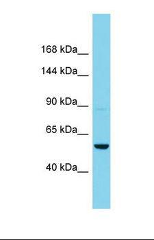 AGAP11 Antibody - Western blot of Human Hela. AGAP11 antibody dilution 1.0 ug/ml.  This image was taken for the unconjugated form of this product. Other forms have not been tested.