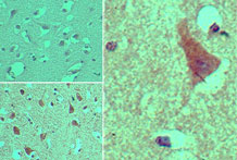 AGAP2 / PIKE Antibody - IHC ofAGAP2 in formalin-fixed, paraffin-embedded human brain tissue using an isotype control (top left) and Peptide-affinity Purified Polyclonal Antibody to AGAP2 (bottom left, right) at 5 ug/ml.