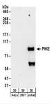 AGAP2 / PIKE Antibody - Detection of Human PIKE by Western Blot. Samples: Whole cell lysate (50 ug) from HeLa, 293T, and Jurkat cells. Antibodies: Affinity purified rabbit anti-PIKE antibody used for WB at 0.1 ug/ml. Detection: Chemiluminescence with an exposure time of 30 seconds.