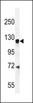 AGAP2 / PIKE Antibody - CENTG1 Antibody western blot of mouse brain tissue lysates (35 ug/lane). The CENTG1 antibody detected the CENTG1 protein (arrow).
