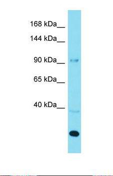 AGAP3 / CENTG3 / MRIP-1 Antibody - Western blot of Human 293T. AGAP3 antibody dilution 1.0 ug/ml.  This image was taken for the unconjugated form of this product. Other forms have not been tested.