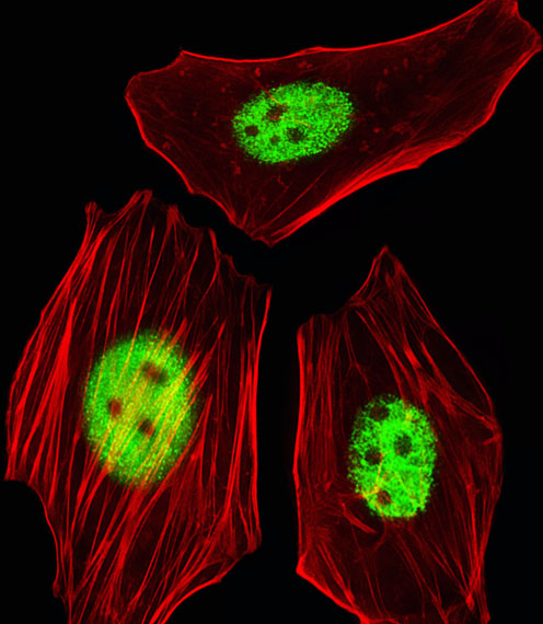 AGAP6 Antibody - Fluorescent image of HeLa cells stained with AGAP8 Antibody (C-term). AGAP8 Antibody (C-term) was diluted at 1:25 dilution. An Alexa Fluor 488-conjugated goat anti-rabbit lgG at 1:400 dilution was used as the secondary antibody (green). Cytoplasmic actin was counterstained with Alexa Fluor® 555 conjugated with Phalloidin (red).