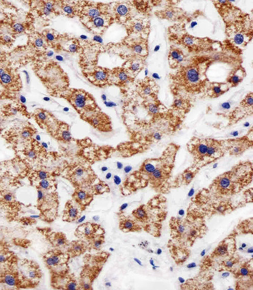 AGAP6 Antibody - Immunohistochemical analysis of paraffin-embedded H. liver section using AGAP8 Antibody (C-term). AGAP8 Antibody (C-term) was diluted at 1:25 dilution. A peroxidase-conjugated goat anti-rabbit IgG at 1:400 dilution was used as the secondary antibody, followed by DAB staining.