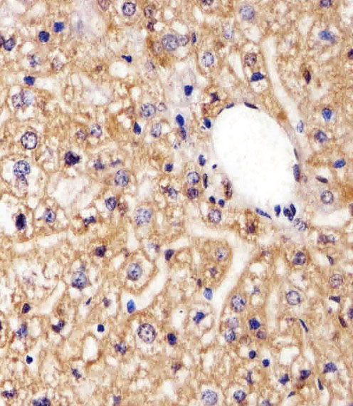 AGAP6 Antibody - Immunohistochemical analysis of paraffin-embedded M. liver section using AGAP8 Antibody (C-term). AGAP8 Antibody (C-term) was diluted at 1:25 dilution. A peroxidase-conjugated goat anti-rabbit IgG at 1:400 dilution was used as the secondary antibody, followed by DAB staining.